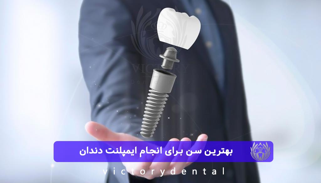 بهترین سن برای انجام ایمپلنت دندان