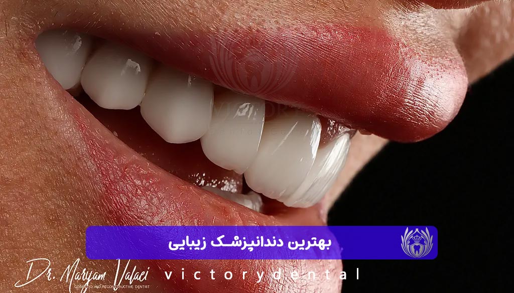 بهترین دندانپزشک زیبایی