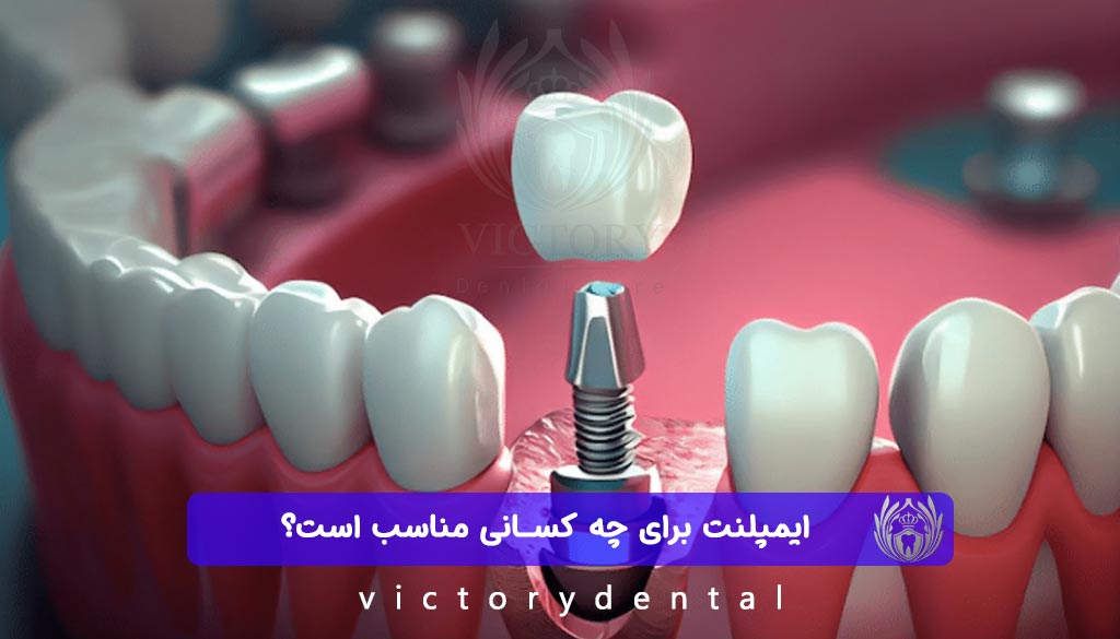 ایمپلنت دندان برای چه کسانی مناسب است؟