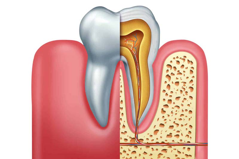 آیا بعد از درمان ریشه باید آنتی بیوتیک مصرف کرد؟