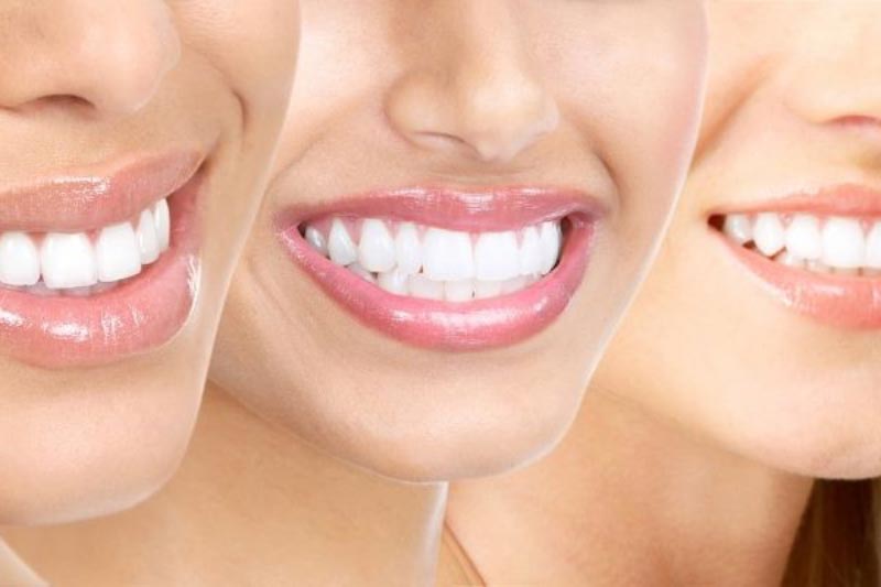 اصلاح طرح لبخند چیست؟