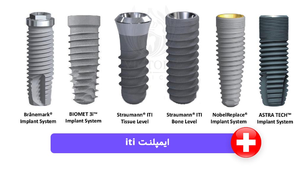 ایمپلنت سوئیسی iti