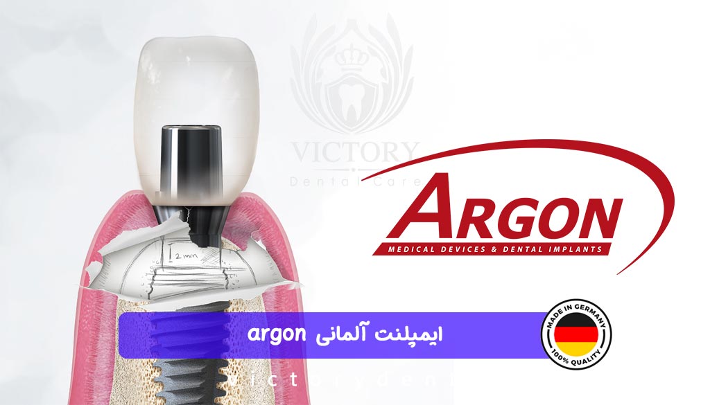 ایمپلنت آلمانی argon