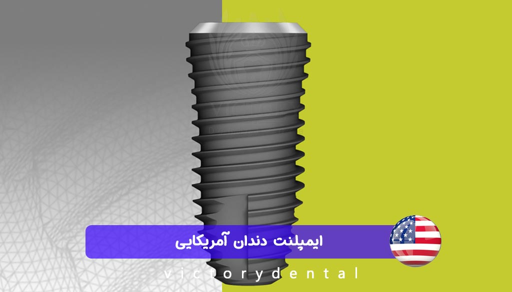 ایمپلنت آمریکایی