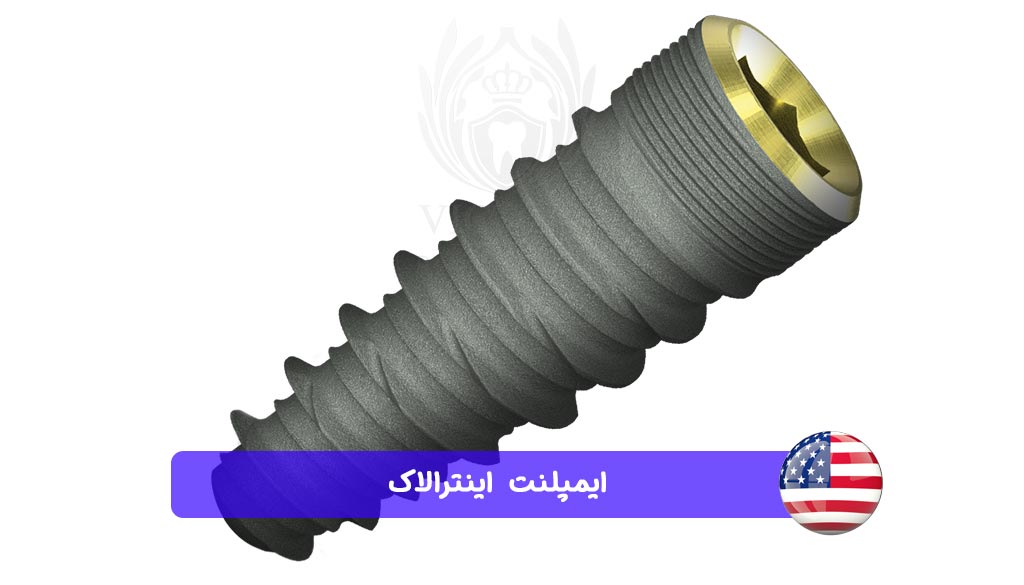 ایمپلنت اینترالاک