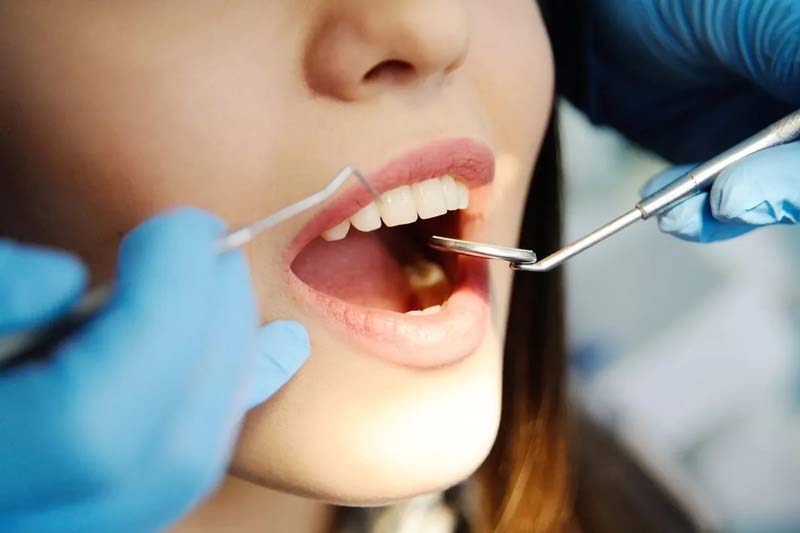 بعد از عصب کشی دندان چه غذاهایی بخوریم چه غذاهایی نخوریم؟