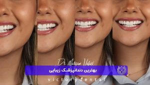 بهترین دندانپزشک زیبایی