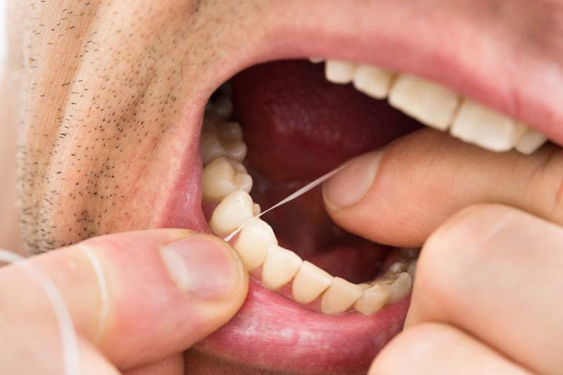 راه های پیشگیری از سیاه شدن دندان چیست؟