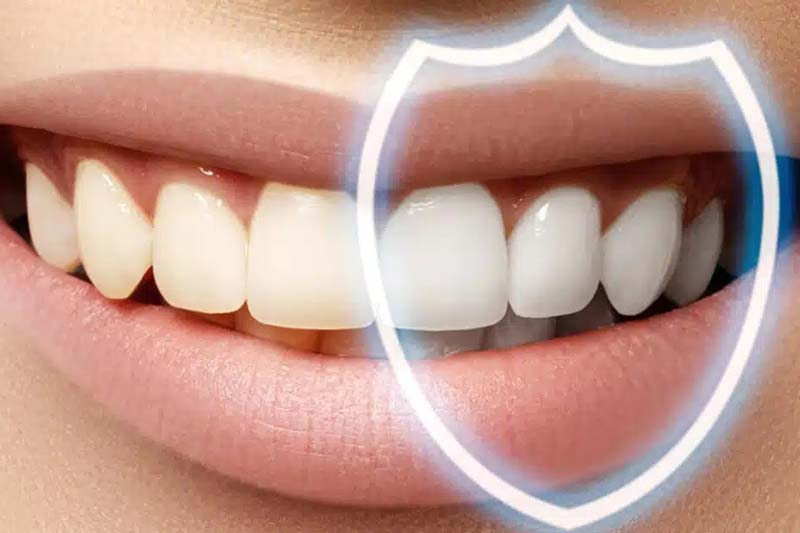عوامل تاثیر گذار در هزینه کامپوزیت دندان در الهیه تهران چیست؟
