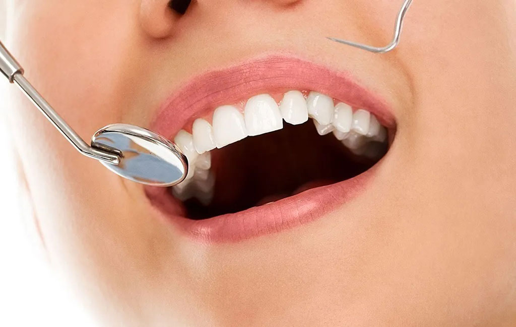 قیمت هر واحد کامپوزیت چند است و ما به چند واحد نیاز داریم؟