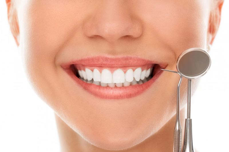 مزایا اصلاح طرح لبخند