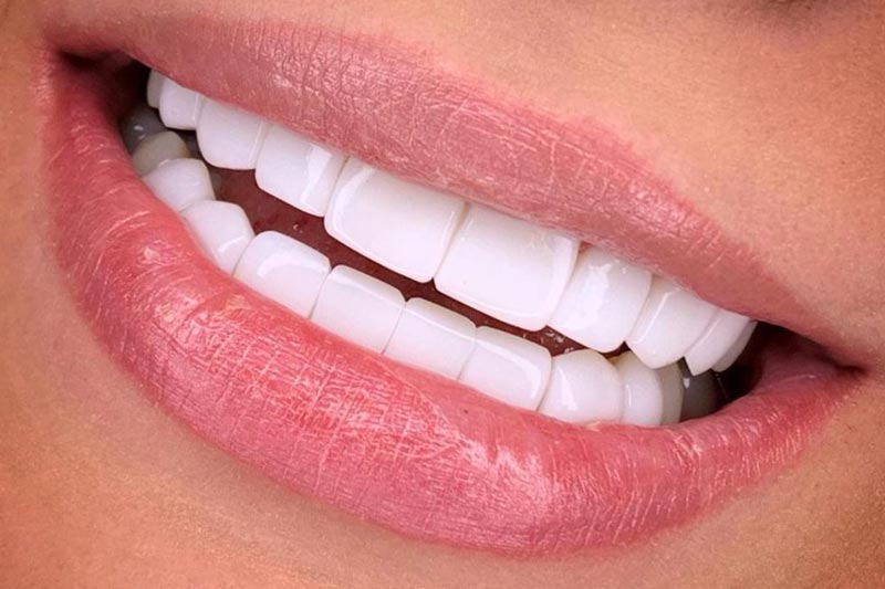 مزایا انتخاب کلینیک ویکتوری دنتال کر