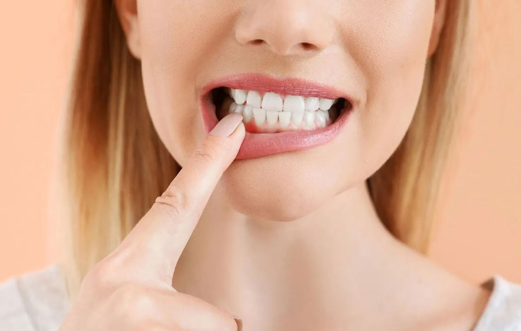 چند ساعت بعد از کشیدن دندان می توانیم گاز استریل را برداریم؟