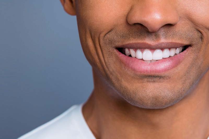 چگونه بهترین نوع کامپوزیت را انتخاب کنیم؟