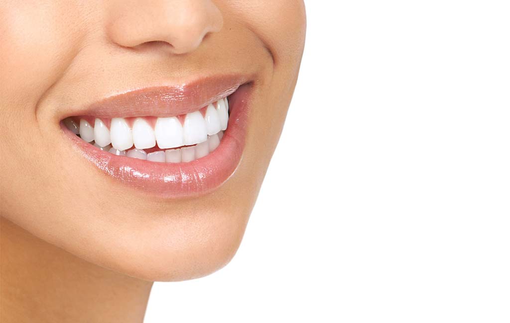 کامپوزیت را انتخاب کنم یا لمینت؟