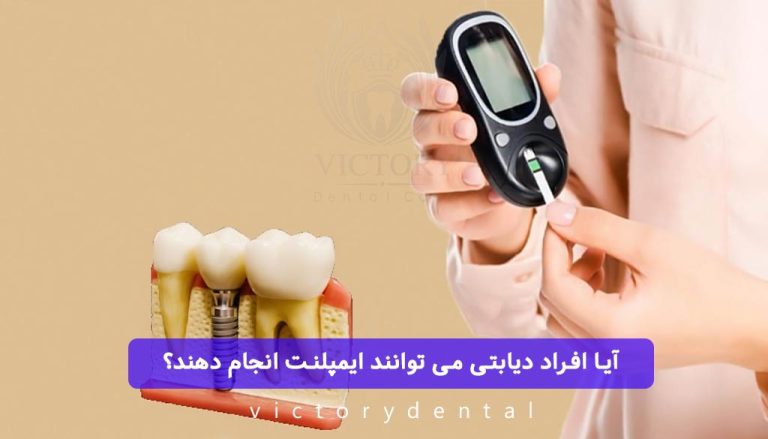 آیا افراد دیابتی می توانند ایمپلنت انجام دهند؟
