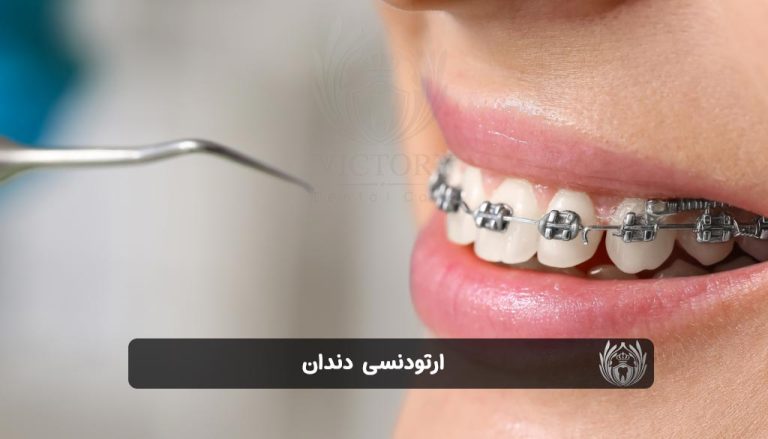 ارتودنسی دندان
