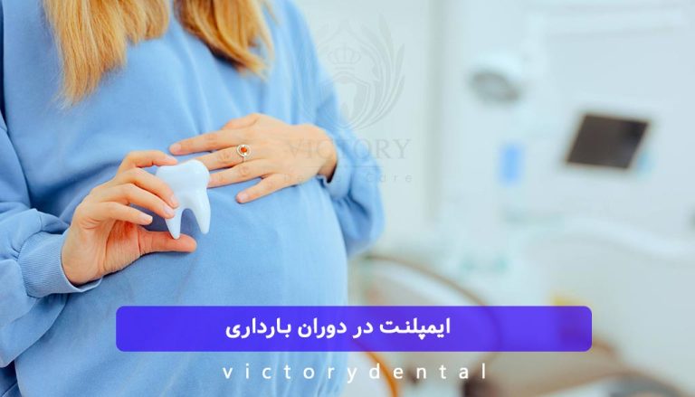 ایمپلنت در دوران بارداری