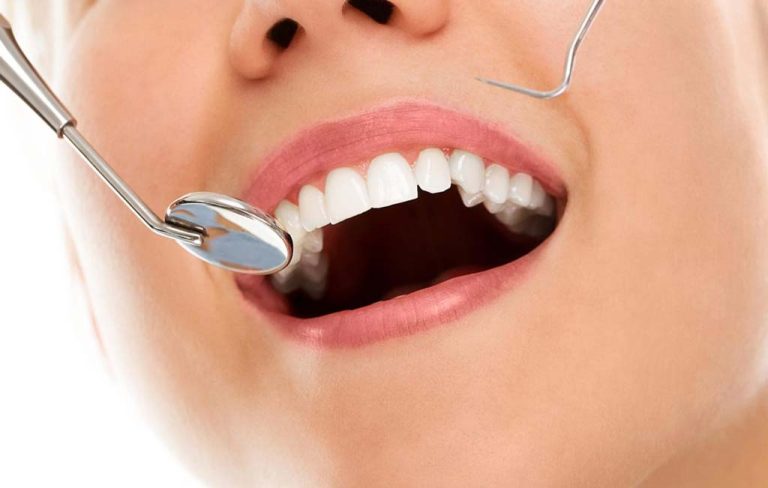 بهترین برند کامپوزیت دندان کدام است؟